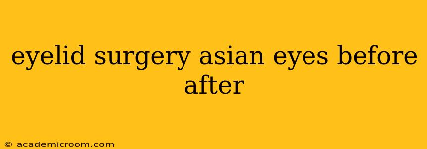 eyelid surgery asian eyes before after