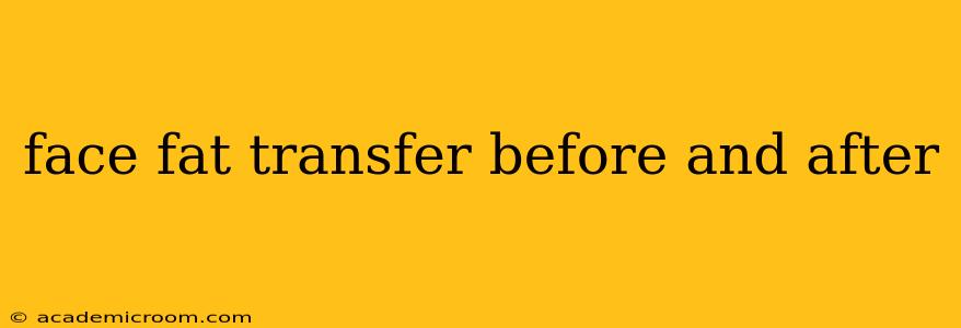 face fat transfer before and after