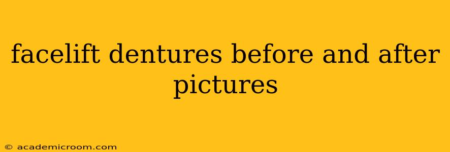 facelift dentures before and after pictures