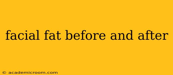 facial fat before and after