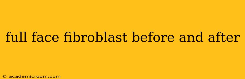 full face fibroblast before and after