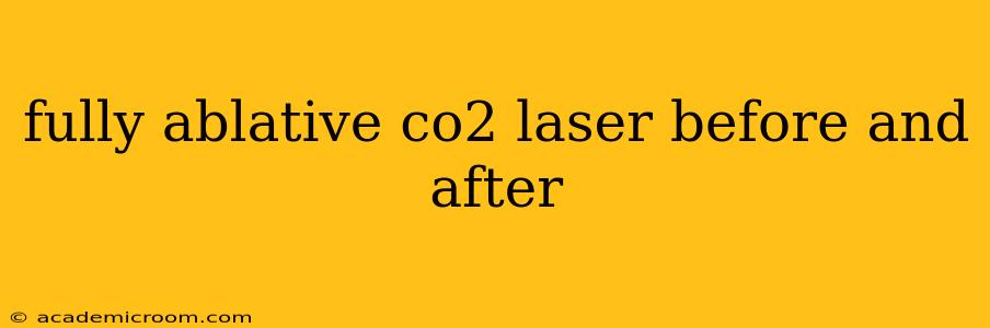 fully ablative co2 laser before and after