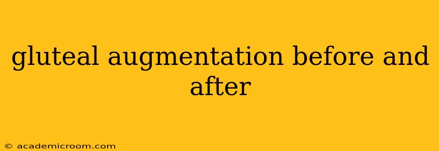 gluteal augmentation before and after