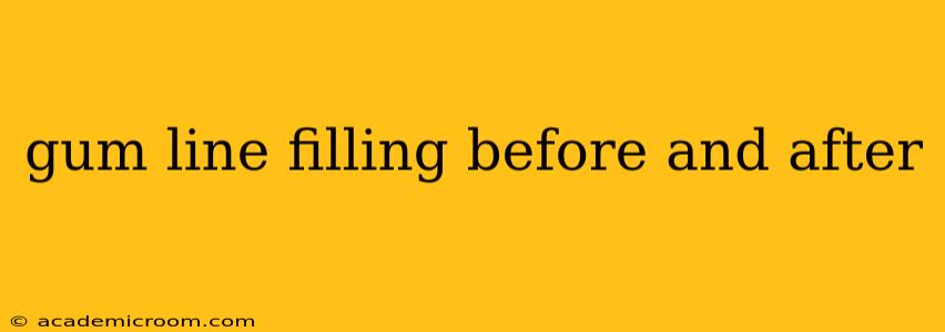 gum line filling before and after