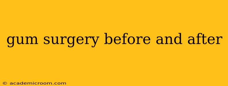 gum surgery before and after