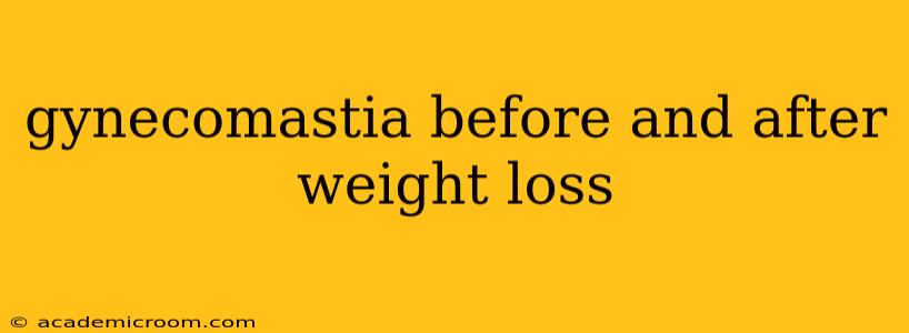 gynecomastia before and after weight loss