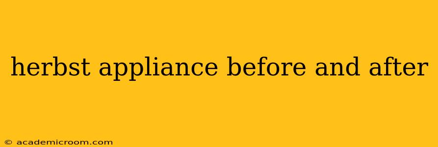 herbst appliance before and after