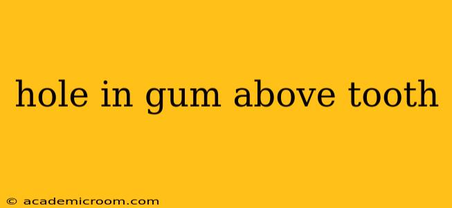 hole in gum above tooth