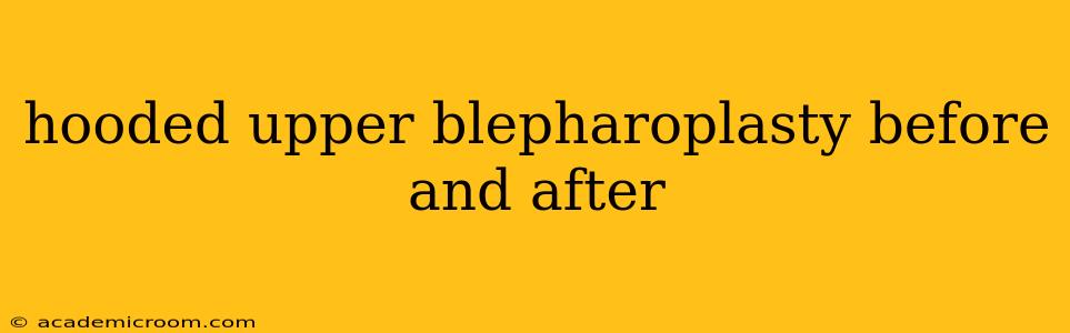hooded upper blepharoplasty before and after