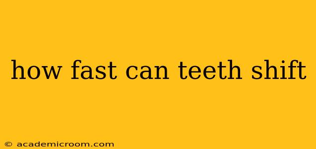 how fast can teeth shift