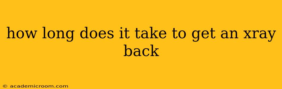 how long does it take to get an xray back