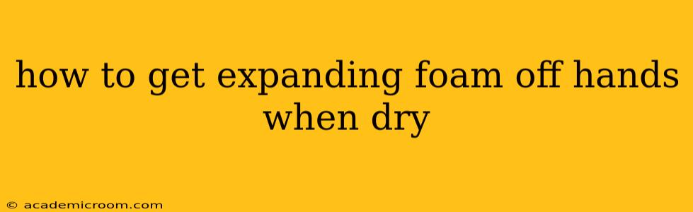 how to get expanding foam off hands when dry