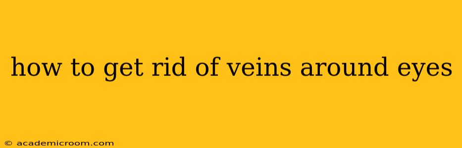 how to get rid of veins around eyes