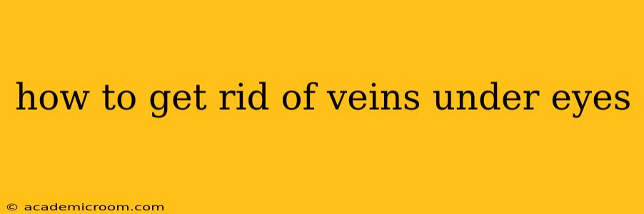 how to get rid of veins under eyes