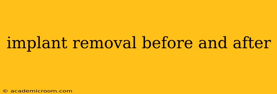 implant removal before and after