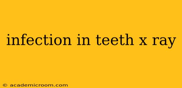 infection in teeth x ray