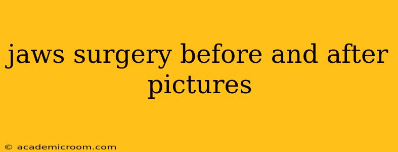 jaws surgery before and after pictures