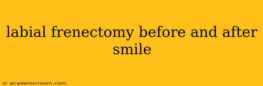 labial frenectomy before and after smile