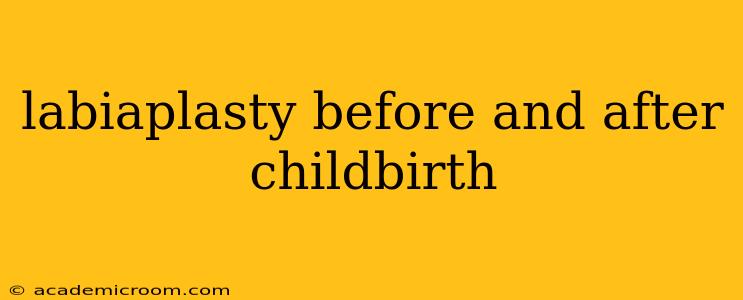 labiaplasty before and after childbirth
