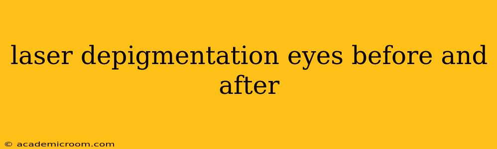 laser depigmentation eyes before and after