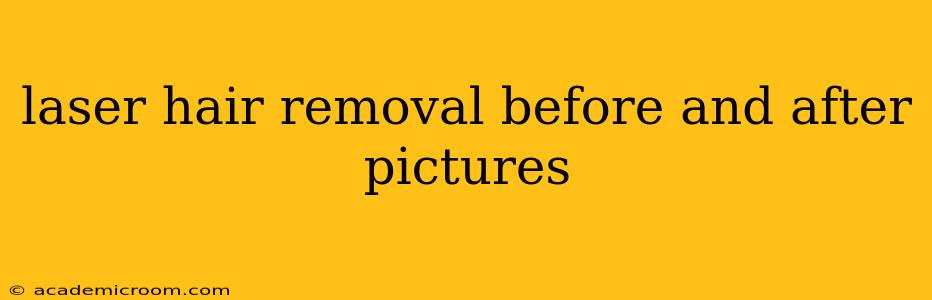 laser hair removal before and after pictures