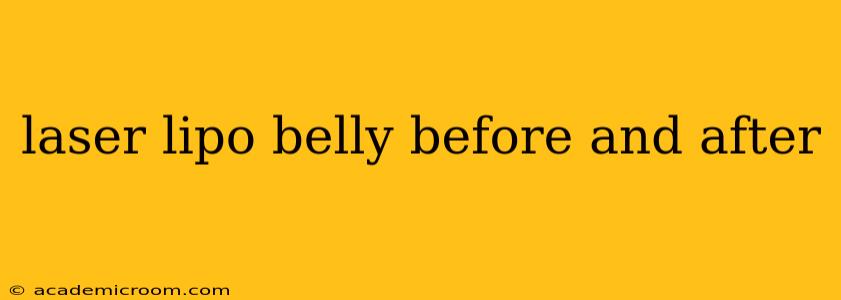 laser lipo belly before and after