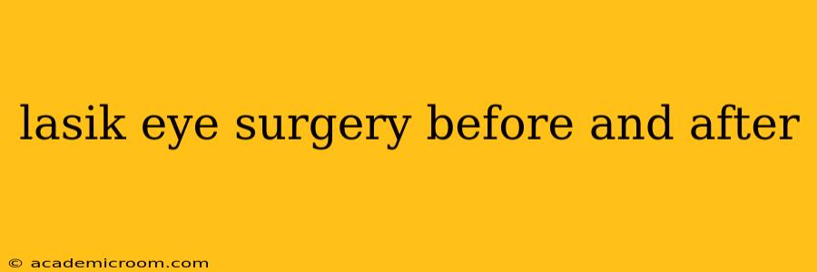lasik eye surgery before and after
