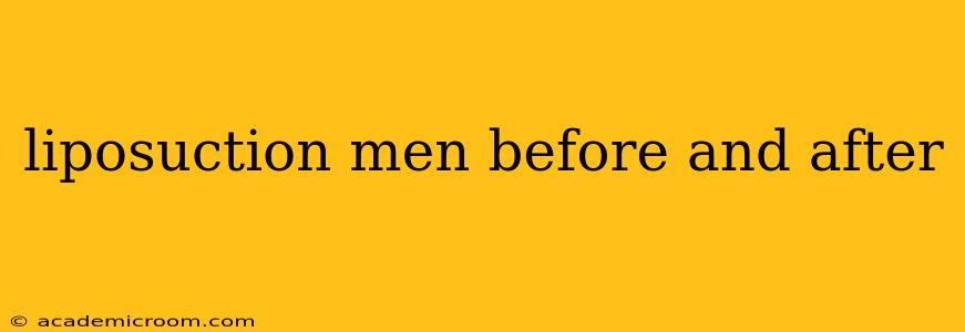 liposuction men before and after
