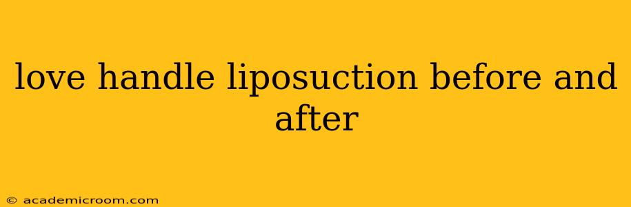 love handle liposuction before and after