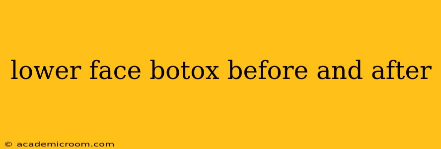 lower face botox before and after