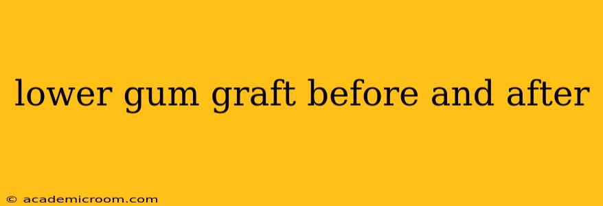 lower gum graft before and after