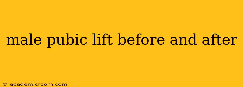 male pubic lift before and after