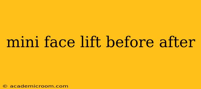 mini face lift before after