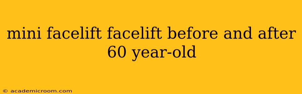 mini facelift facelift before and after 60 year-old