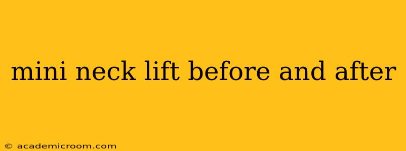 mini neck lift before and after