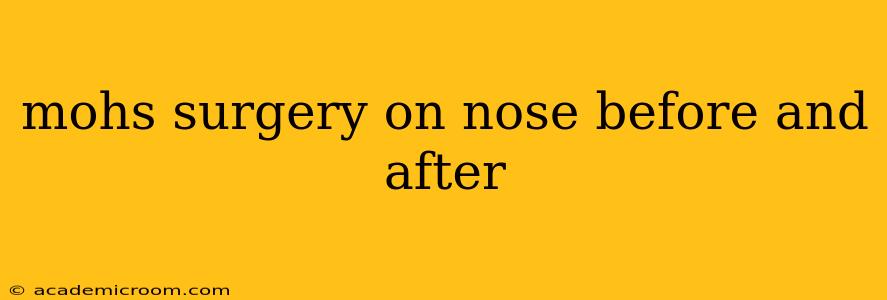 mohs surgery on nose before and after