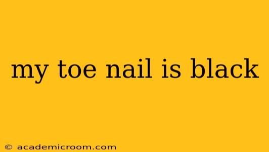 my toe nail is black