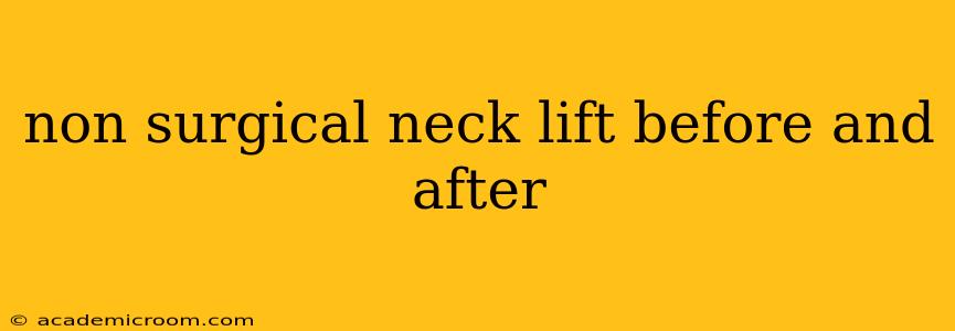 non surgical neck lift before and after