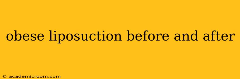 obese liposuction before and after