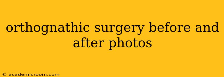 orthognathic surgery before and after photos