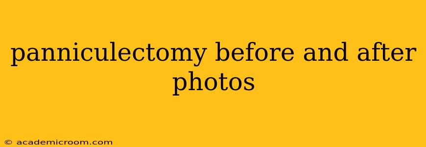 panniculectomy before and after photos