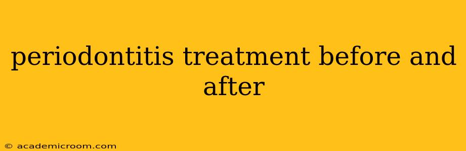 periodontitis treatment before and after