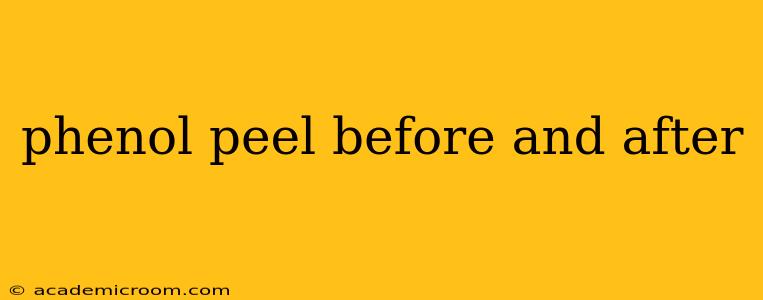 phenol peel before and after