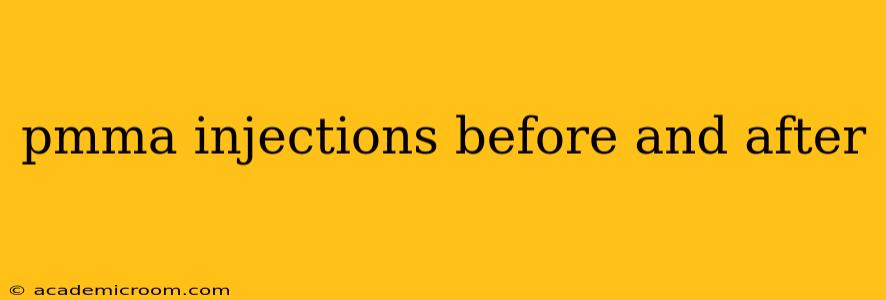 pmma injections before and after
