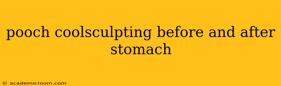 pooch coolsculpting before and after stomach