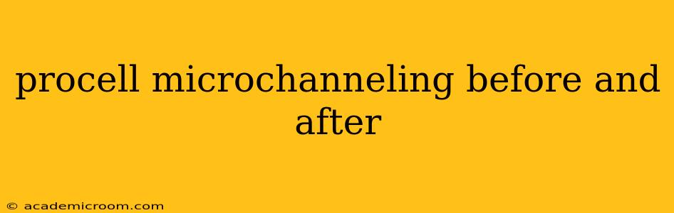 procell microchanneling before and after