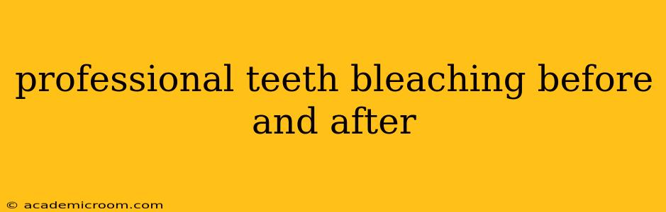 professional teeth bleaching before and after