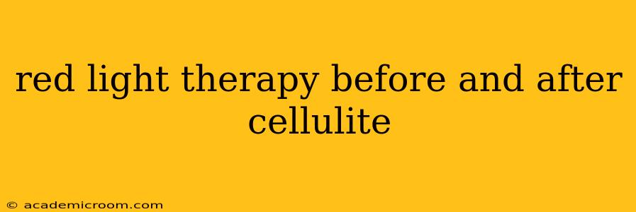 red light therapy before and after cellulite