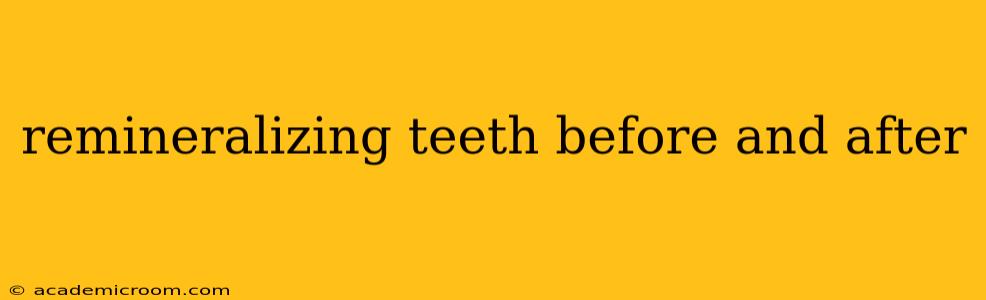 remineralizing teeth before and after