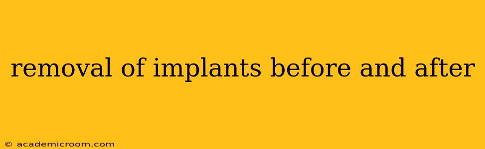 removal of implants before and after
